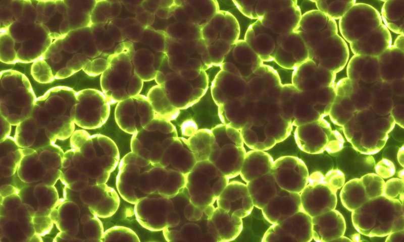 https://nfusion-tech.com/wp-content/uploads/2020/11/detecting-bacteria-with-fluorescent-nanosensors_5fbf7c875a83d.jpeg